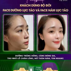 Soo Young - Green Algae Whitening and Soo young Melasma cream  Set